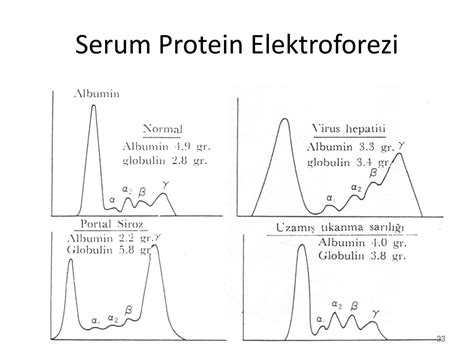 protein elektroforezi yorumlama